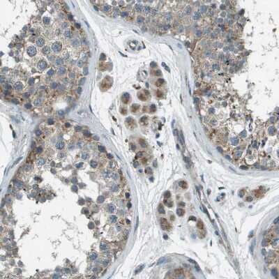 Immunohistochemistry-Paraffin: FAM73A Antibody [NBP1-93832]