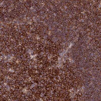 Immunohistochemistry-Paraffin: FAM76A Antibody [NBP1-81103]