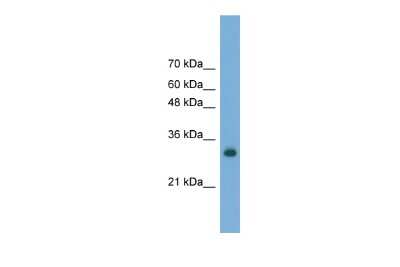 Western Blot: FAM78A Antibody [NBP2-87428]