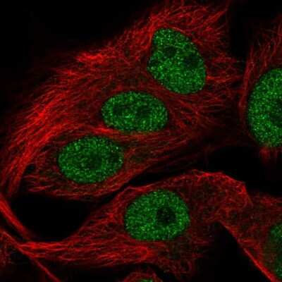 Immunocytochemistry/ Immunofluorescence: FAM81A Antibody [NBP2-56437]