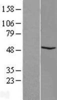Western Blot: FAM81B Overexpression Lysate [NBL1-10570]