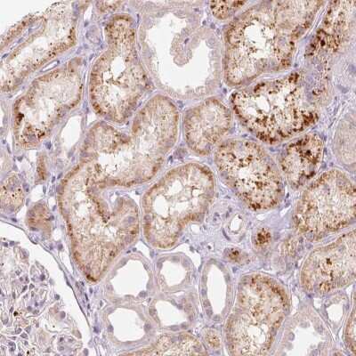 Immunohistochemistry: FAM82A Antibody [NBP2-38216]