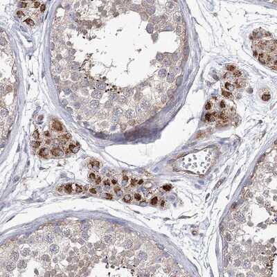 Immunohistochemistry-Paraffin: FAM82A Antibody [NBP1-87934]