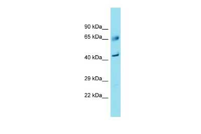 Western Blot: FAM83A Antibody [NBP3-09712]