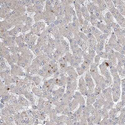 Immunohistochemistry-Paraffin: FAM83B Antibody [NBP1-86764]
