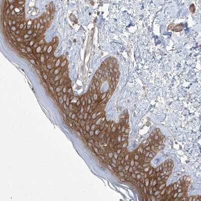 Immunohistochemistry-Paraffin: FAM83B Antibody [NBP1-86764]