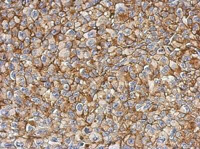 Immunohistochemistry-Paraffin: FAM83B Antibody [NBP2-16423]