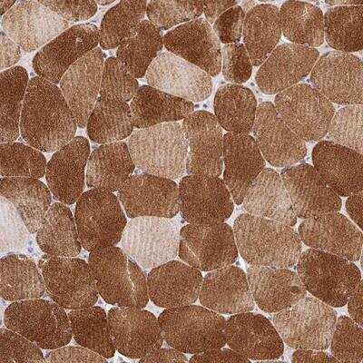 Immunohistochemistry-Paraffin: FAM83E Antibody [NBP2-14004]