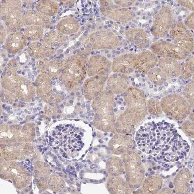Immunohistochemistry-Paraffin: FAM83E Antibody [NBP2-14004]