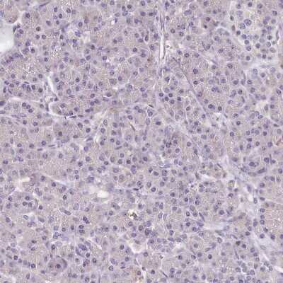 Immunohistochemistry-Paraffin: FAM83E Antibody [NBP2-14004]