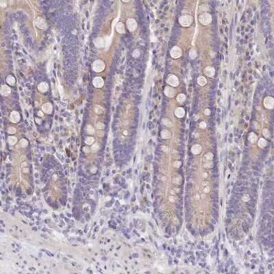 Immunohistochemistry-Paraffin: FAM83E Antibody [NBP2-14004]