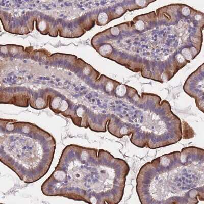 Immunohistochemistry-Paraffin: FAM83F Antibody [NBP2-14005]