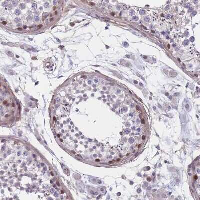 Immunohistochemistry-Paraffin: FAM83F Antibody [NBP2-14005]