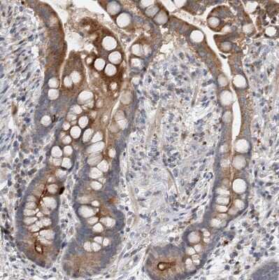 Immunohistochemistry-Paraffin: FAM83G Antibody [NBP1-93771]