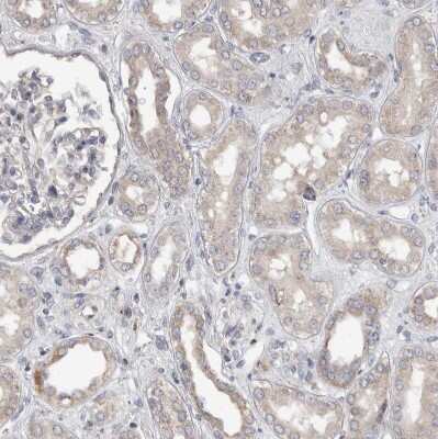 Immunohistochemistry-Paraffin: FAM83G Antibody [NBP1-93771]