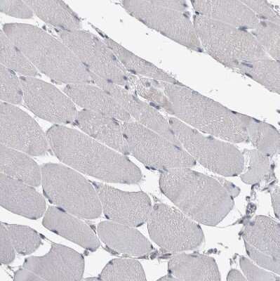 Immunohistochemistry-Paraffin: FAM83G Antibody [NBP1-93771]