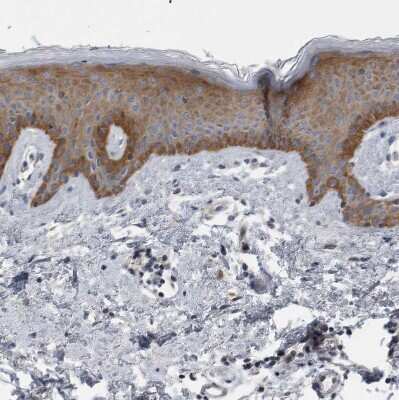 Immunohistochemistry-Paraffin: FAM83G Antibody [NBP1-93771]
