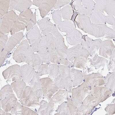 Immunohistochemistry-Paraffin: FAM83G Antibody [NBP1-93772]