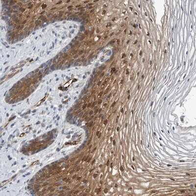 Immunohistochemistry-Paraffin: FAM83H Antibody [NBP1-93738]