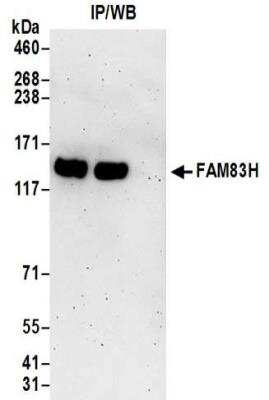 Immunoprecipitation: FAM83H Antibody [NBP2-32219]