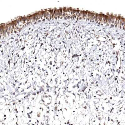 Immunohistochemistry-Paraffin: FAM91A1 Antibody [NBP1-83576]