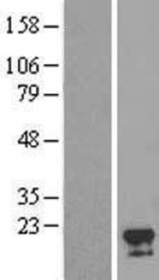 Western Blot: FAM96A Overexpression Lysate [NBL1-10583]