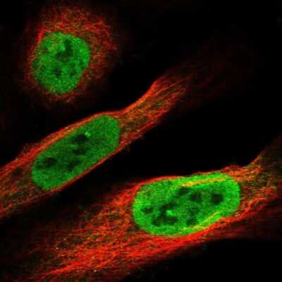 Immunocytochemistry/ Immunofluorescence: FAM9B Antibody [NBP1-89431]