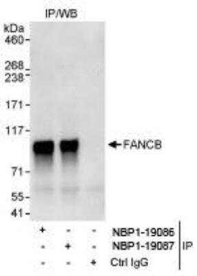 Immunoprecipitation: FANCB Antibody [NBP1-19087]