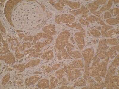 Immunohistochemistry-Paraffin: FANCB Antibody (M38P3E10) - BSA Free [NBP2-52406]