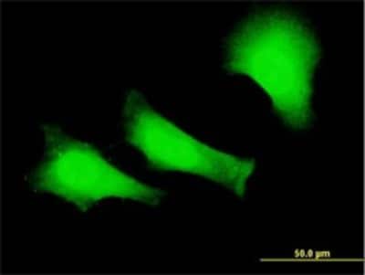 Immunocytochemistry/ Immunofluorescence: FANCC Antibody (6E7) [H00002176-M01]