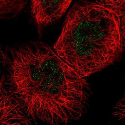 Immunocytochemistry/ Immunofluorescence: FANCC Antibody [NBP2-55256]