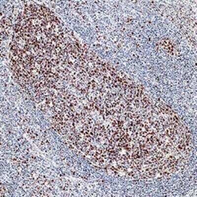 Immunohistochemistry-Paraffin: FANCD2 Antibody (1290D) - Azide and BSA Free [NBP2-80729]