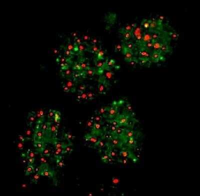 Immunocytochemistry/ Immunofluorescence: FANCD2 Antibody - BSA Free [NB100-182]