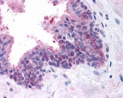 Immunohistochemistry: FANCD2 Antibody - BSA Free [NB100-182]