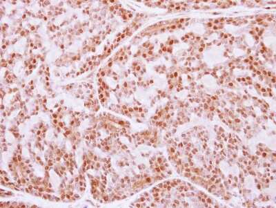 Immunohistochemistry-Paraffin: FANCE Antibody [NBP2-16428]