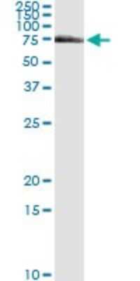 Immunoprecipitation: FANCG Antibody (2C8) [H00002189-M01]