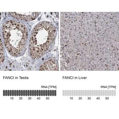 Immunohistochemistry-Paraffin: FANCI Antibody [NBP1-84608]