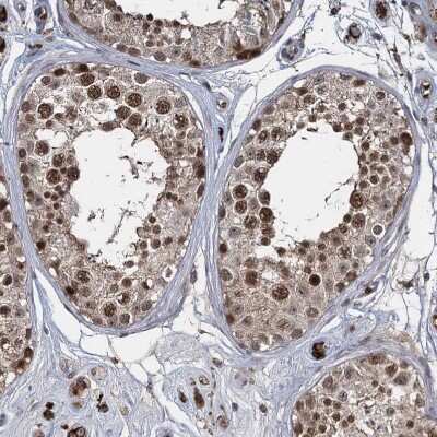 Immunohistochemistry-Paraffin: FANCI Antibody [NBP1-84608]