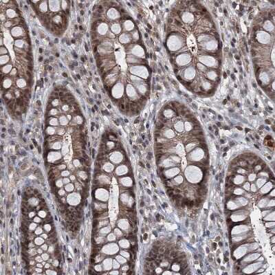 Immunohistochemistry-Paraffin: FANCI Antibody [NBP1-84608]