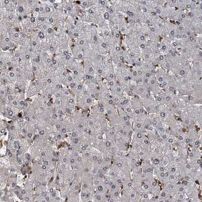 Immunohistochemistry-Paraffin: FANCI Antibody [NBP1-84608]