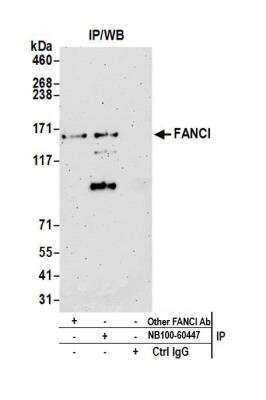 Immunoprecipitation: FANCI Antibody [NB100-60447]