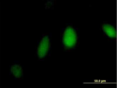 Immunocytochemistry/ Immunofluorescence: FANCL Antibody [H00055120-B01P]