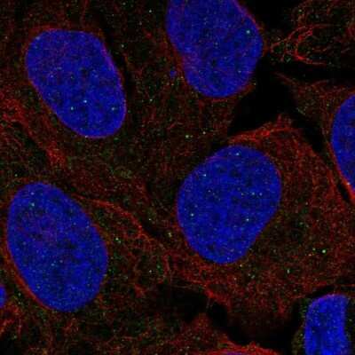 Immunocytochemistry/ Immunofluorescence: FANCL Antibody [NBP1-84758]