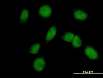 Immunocytochemistry/ Immunofluorescence: FANCM Antibody [H00057697-B01P]