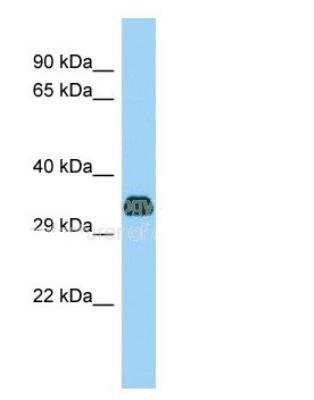 Western Blot: FANK1 Antibody [NBP2-59799]