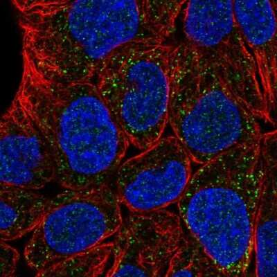 Immunocytochemistry/ Immunofluorescence: FAR1 Antibody [NBP1-89847]