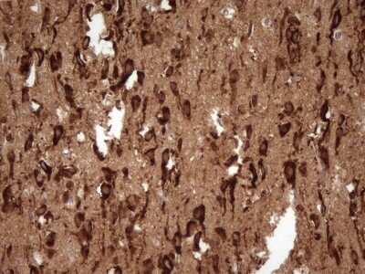 Immunohistochemistry: FARSB Antibody (OTI4B3) [NBP2-45577]