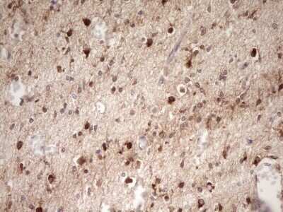 Immunohistochemistry: FARSB Antibody (OTI4B3) - Azide and BSA Free [NBP2-71539]