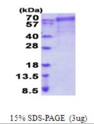 SDS-PAGE: Recombinant Human FARSB His Protein [NBP2-51968]
