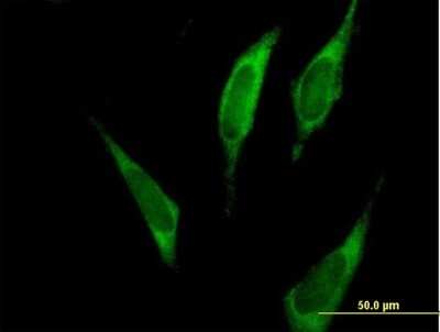 Immunocytochemistry/ Immunofluorescence: FARSLA Antibody [H00002193-B01P]